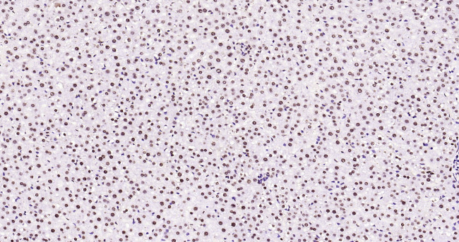 Histone H3 (di methyl K27) Antibody in Immunohistochemistry (Paraffin) (IHC (P))