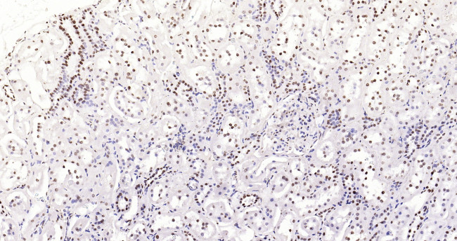 Histone H3 (di methyl K27) Antibody in Immunohistochemistry (Paraffin) (IHC (P))