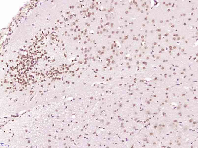 Histone H3 (di methyl K79) Antibody in Immunohistochemistry (Paraffin) (IHC (P))