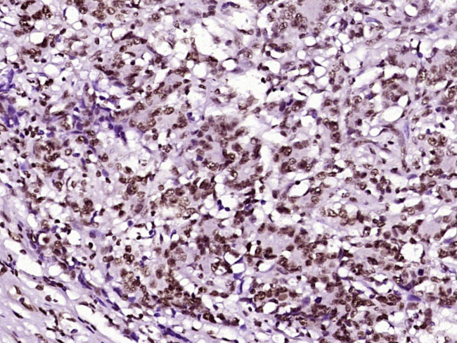 Histone H3 (di methyl K79) Antibody in Immunohistochemistry (Paraffin) (IHC (P))