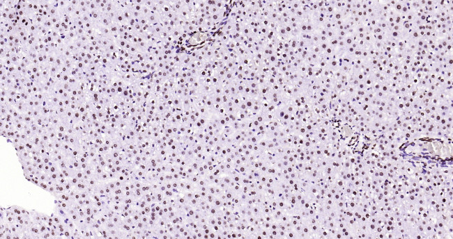 Histone H3 (di methyl K79) Antibody in Immunohistochemistry (Paraffin) (IHC (P))