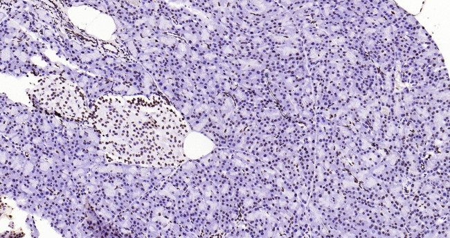 Histone H3 (di methyl K79) Antibody in Immunohistochemistry (Paraffin) (IHC (P))