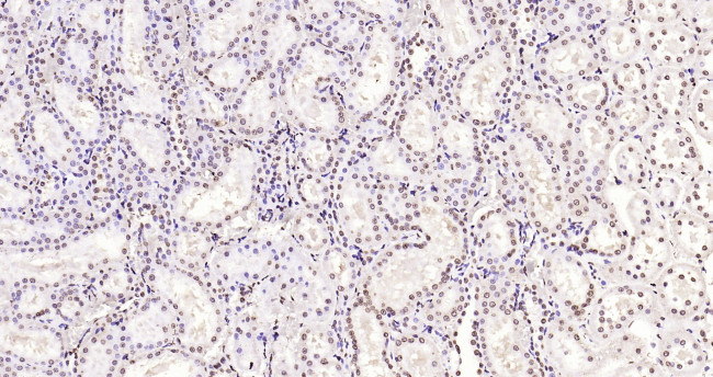 Histone H3 (di methyl K79) Antibody in Immunohistochemistry (Paraffin) (IHC (P))