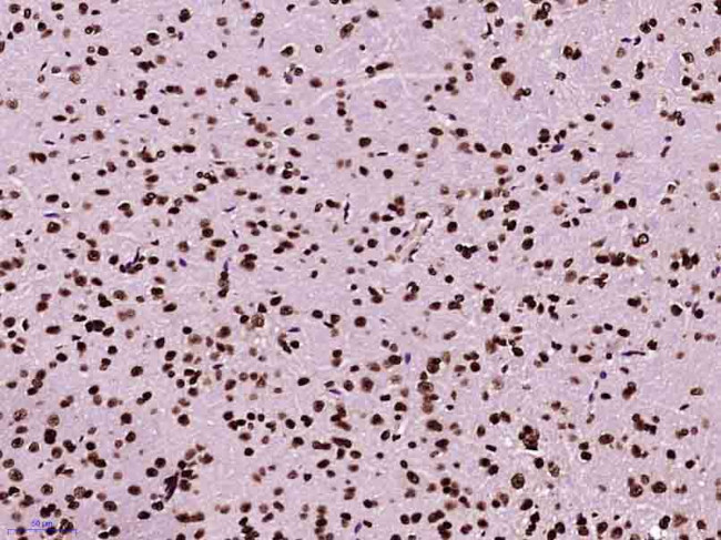 Histone H3 (di methyl K79) Antibody in Immunohistochemistry (Paraffin) (IHC (P))