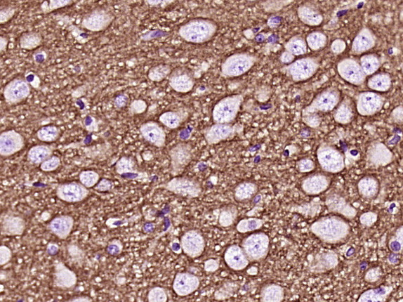 GAP43 Antibody in Immunohistochemistry (Paraffin) (IHC (P))