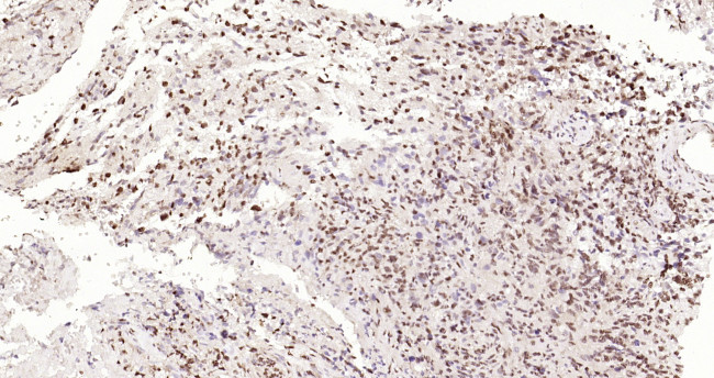 P53 Antibody in Immunohistochemistry (Paraffin) (IHC (P))