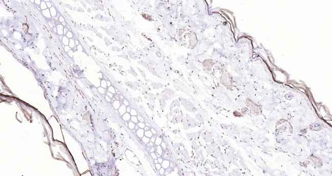 P53 Antibody in Immunohistochemistry (Paraffin) (IHC (P))