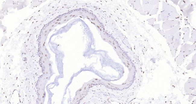 P53 Antibody in Immunohistochemistry (Paraffin) (IHC (P))