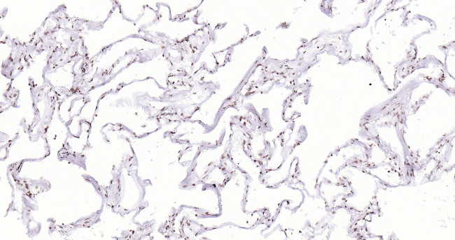 P53 Antibody in Immunohistochemistry (Paraffin) (IHC (P))