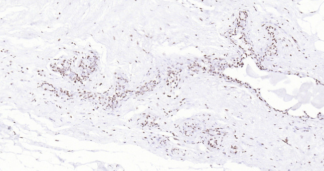 P53 Antibody in Immunohistochemistry (Paraffin) (IHC (P))