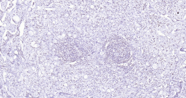 P53 Antibody in Immunohistochemistry (Paraffin) (IHC (P))