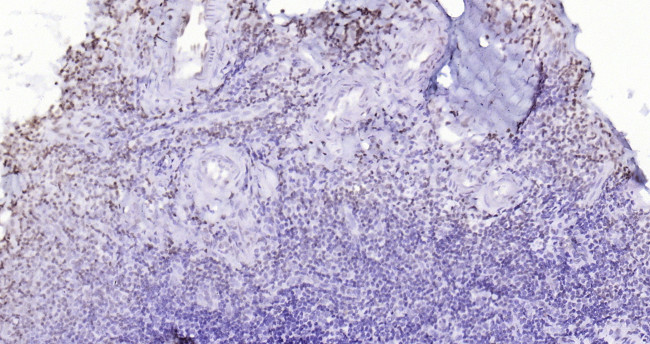 P53 Antibody in Immunohistochemistry (Paraffin) (IHC (P))