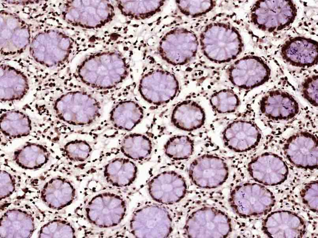 P53 Antibody in Immunohistochemistry (Paraffin) (IHC (P))