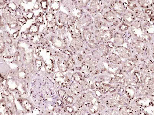 P53 Antibody in Immunohistochemistry (Paraffin) (IHC (P))