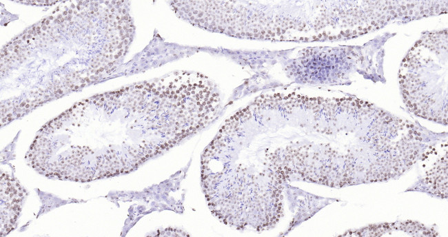 P53 Antibody in Immunohistochemistry (Paraffin) (IHC (P))