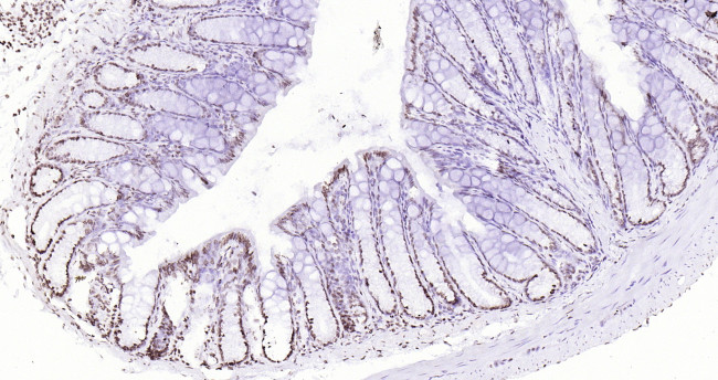 P53 Antibody in Immunohistochemistry (Paraffin) (IHC (P))