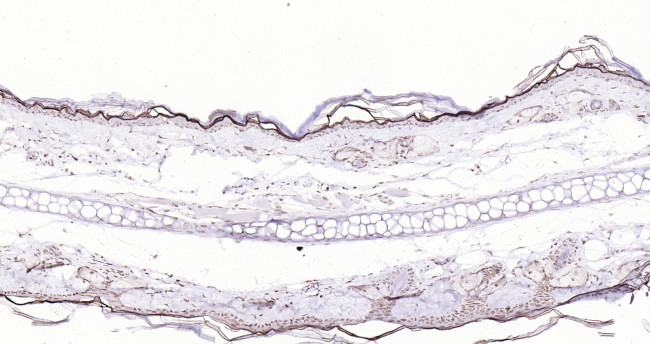 P53 Antibody in Immunohistochemistry (Paraffin) (IHC (P))