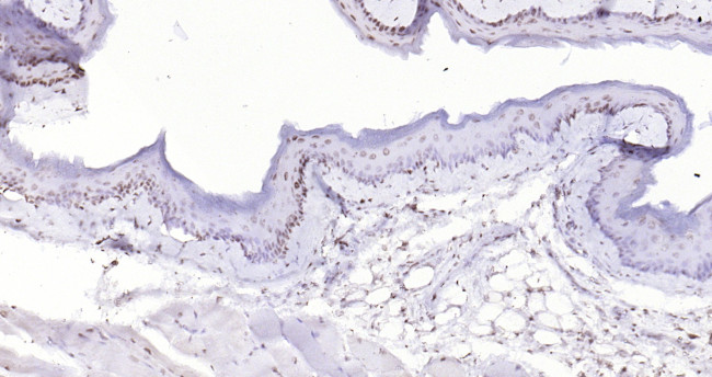 P53 Antibody in Immunohistochemistry (Paraffin) (IHC (P))