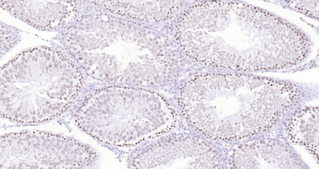 P53 Antibody in Immunohistochemistry (Paraffin) (IHC (P))