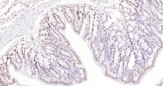 P53 Antibody in Immunohistochemistry (Paraffin) (IHC (P))