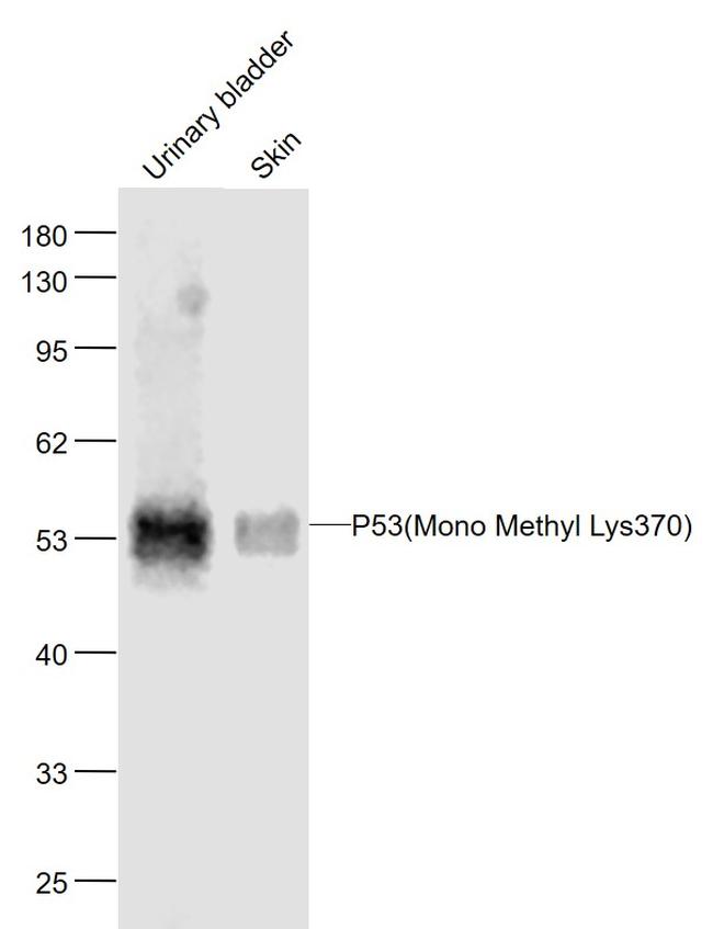 P53 Antibody in Western Blot (WB)