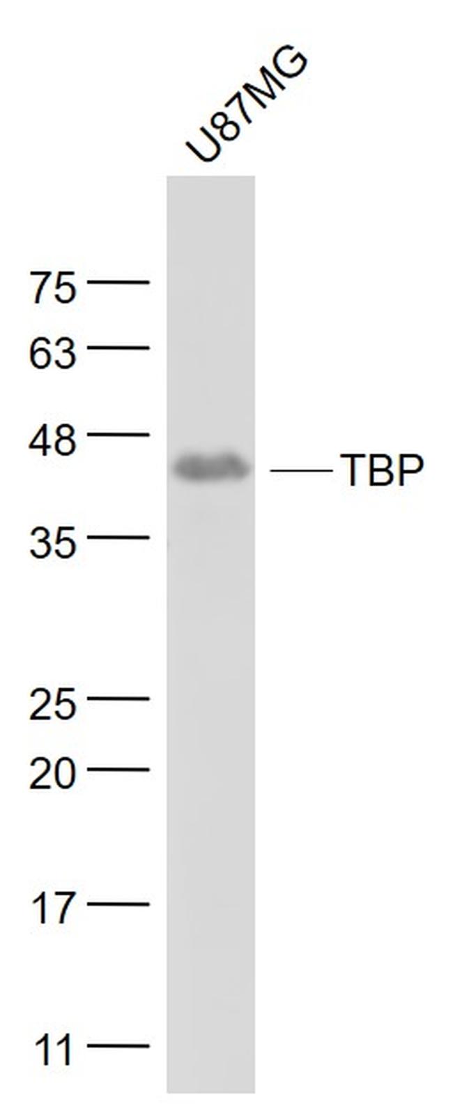 TATA binding protein TBP/TBP Antibody in Western Blot (WB)