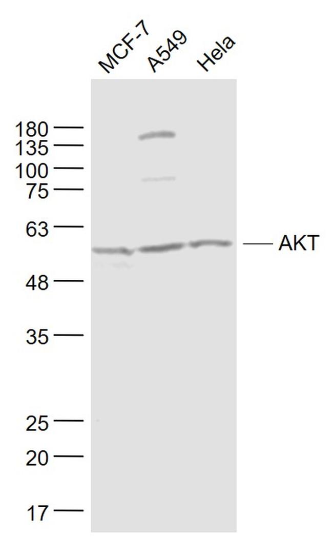 AKT Antibody in Western Blot (WB)