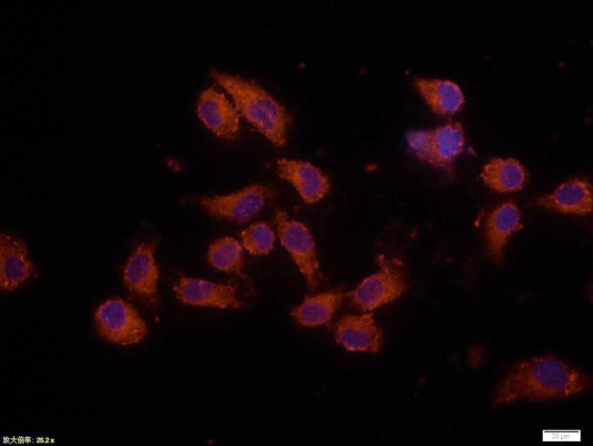 Bax Antibody in Immunocytochemistry (ICC/IF)