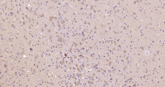 GSK-3 Beta Antibody in Immunohistochemistry (Paraffin) (IHC (P))