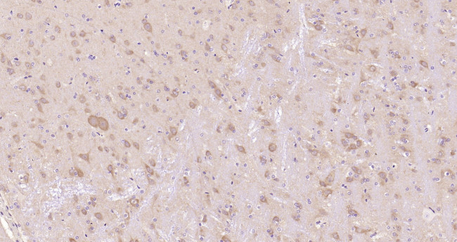 GSK-3 Beta Antibody in Immunohistochemistry (Paraffin) (IHC (P))