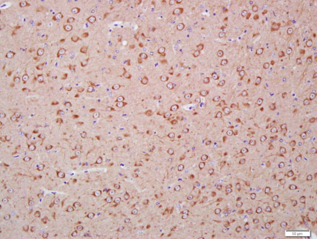 LC3A Antibody in Immunohistochemistry (Paraffin) (IHC (P))