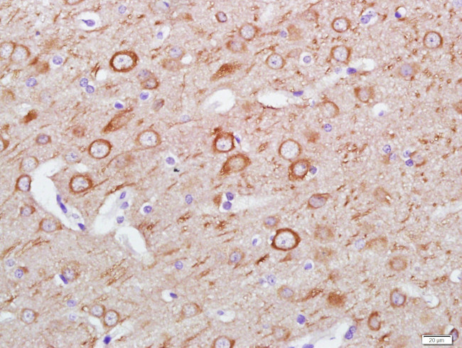 LC3A Antibody in Immunohistochemistry (Paraffin) (IHC (P))