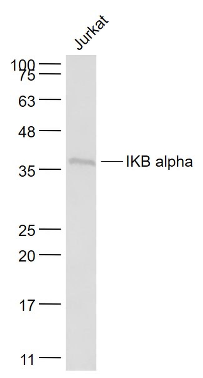 IKB alpha Antibody in Western Blot (WB)