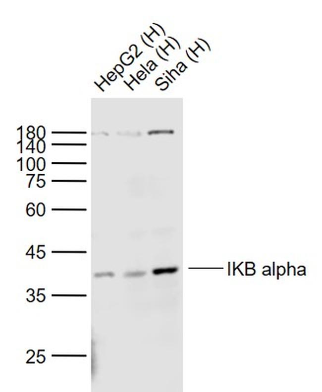 IKB alpha Antibody in Western Blot (WB)