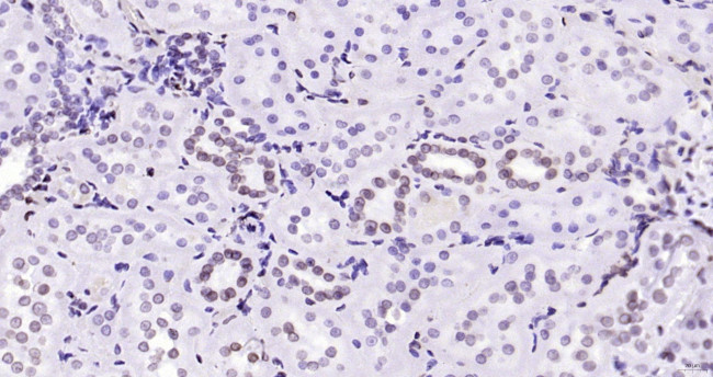 Lamin A/C Antibody in Immunohistochemistry (Paraffin) (IHC (P))