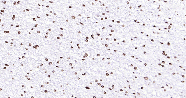 Lamin A/C Antibody in Immunohistochemistry (Paraffin) (IHC (P))