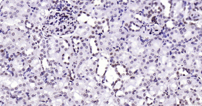 Lamin A/C Antibody in Immunohistochemistry (Paraffin) (IHC (P))