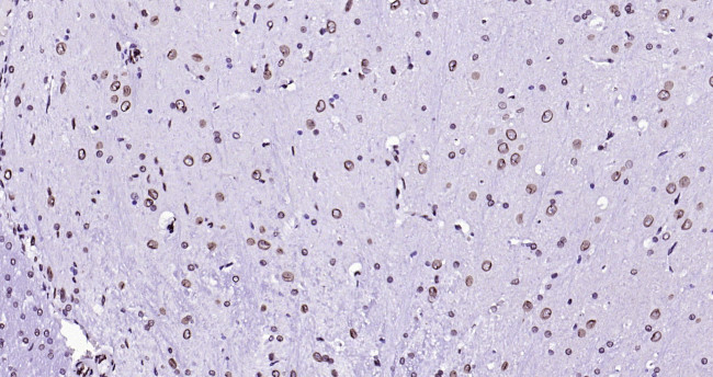 Lamin A/C Antibody in Immunohistochemistry (Paraffin) (IHC (P))