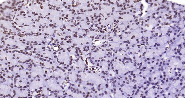 Lamin A/C Antibody in Immunohistochemistry (Paraffin) (IHC (P))