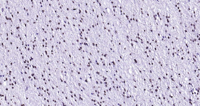 Lamin A/C Antibody in Immunohistochemistry (Paraffin) (IHC (P))