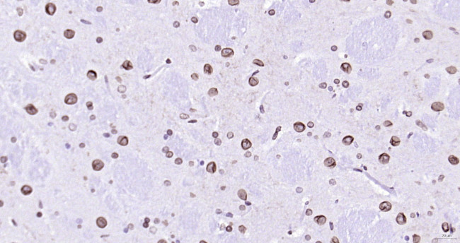 Lamin A/C Antibody in Immunohistochemistry (Paraffin) (IHC (P))