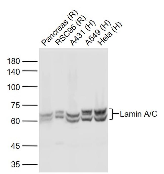 Lamin A/C Antibody in Western Blot (WB)