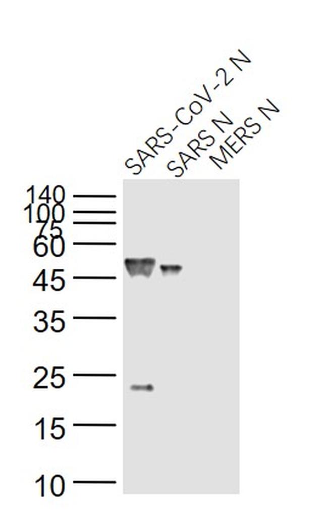 SARS Nucleocapsid Protein Antibody in Western Blot (WB)