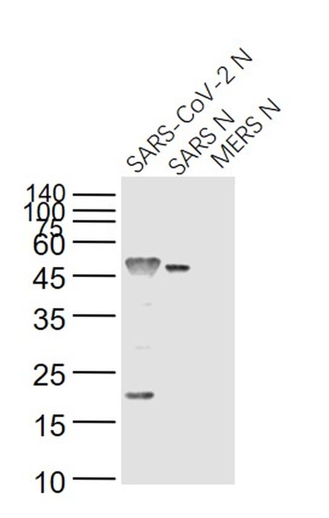 SARS Nucleocapsid Protein Antibody in Western Blot (WB)