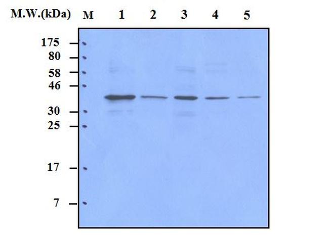 p38 MAPK Antibody in Western Blot (WB)