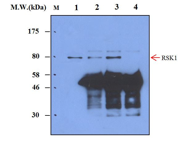 p90RSK1 Antibody in Immunoprecipitation (IP)