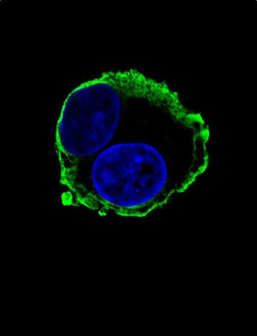 MMP14 Antibody in Immunocytochemistry (ICC/IF)