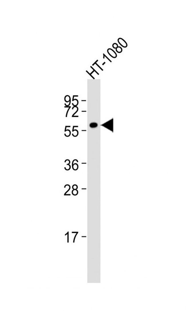 MMP14 Antibody in Western Blot (WB)