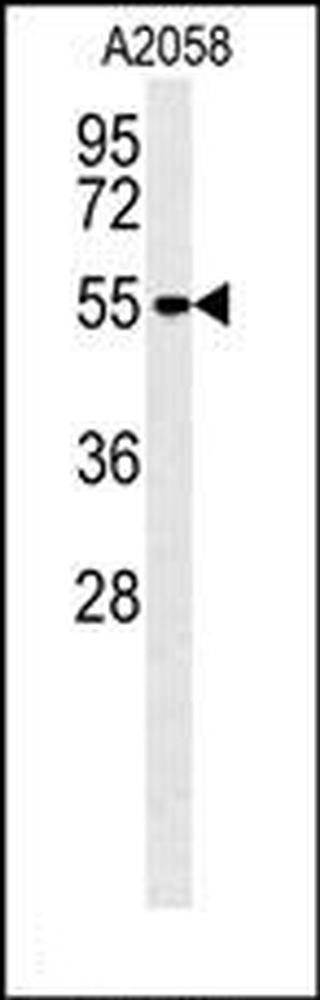 MMP14 Antibody in Western Blot (WB)