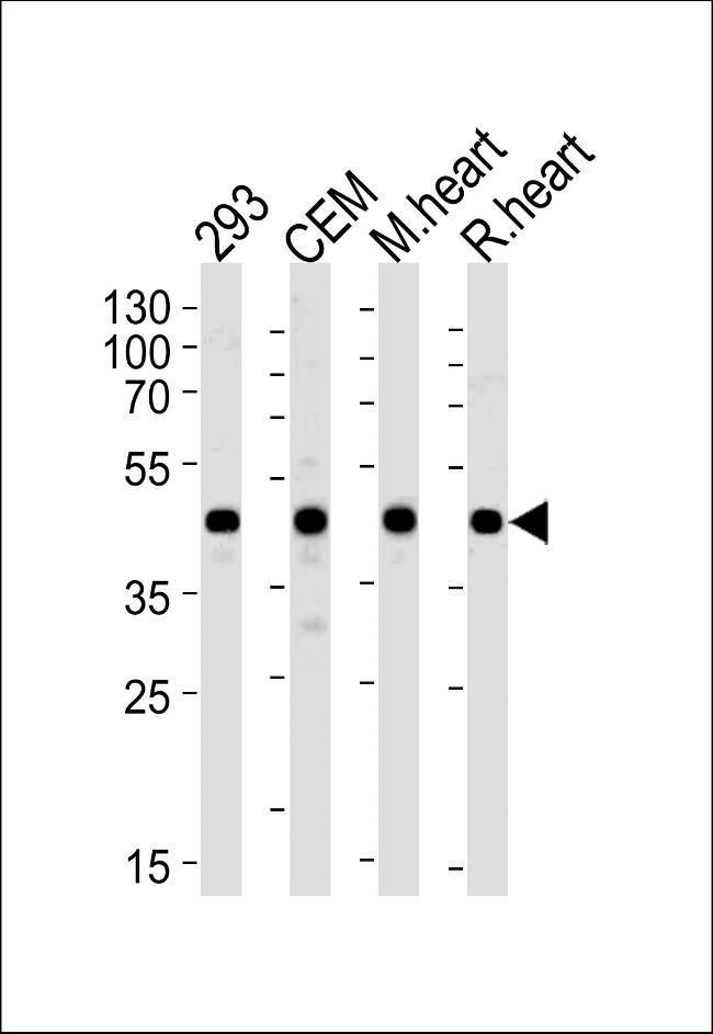 VEGFC Antibody in Western Blot (WB)